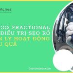 Laser CO2 fractional trong điều trị sẹo rỗ: nguyên lý hoạt động và hiệu quả