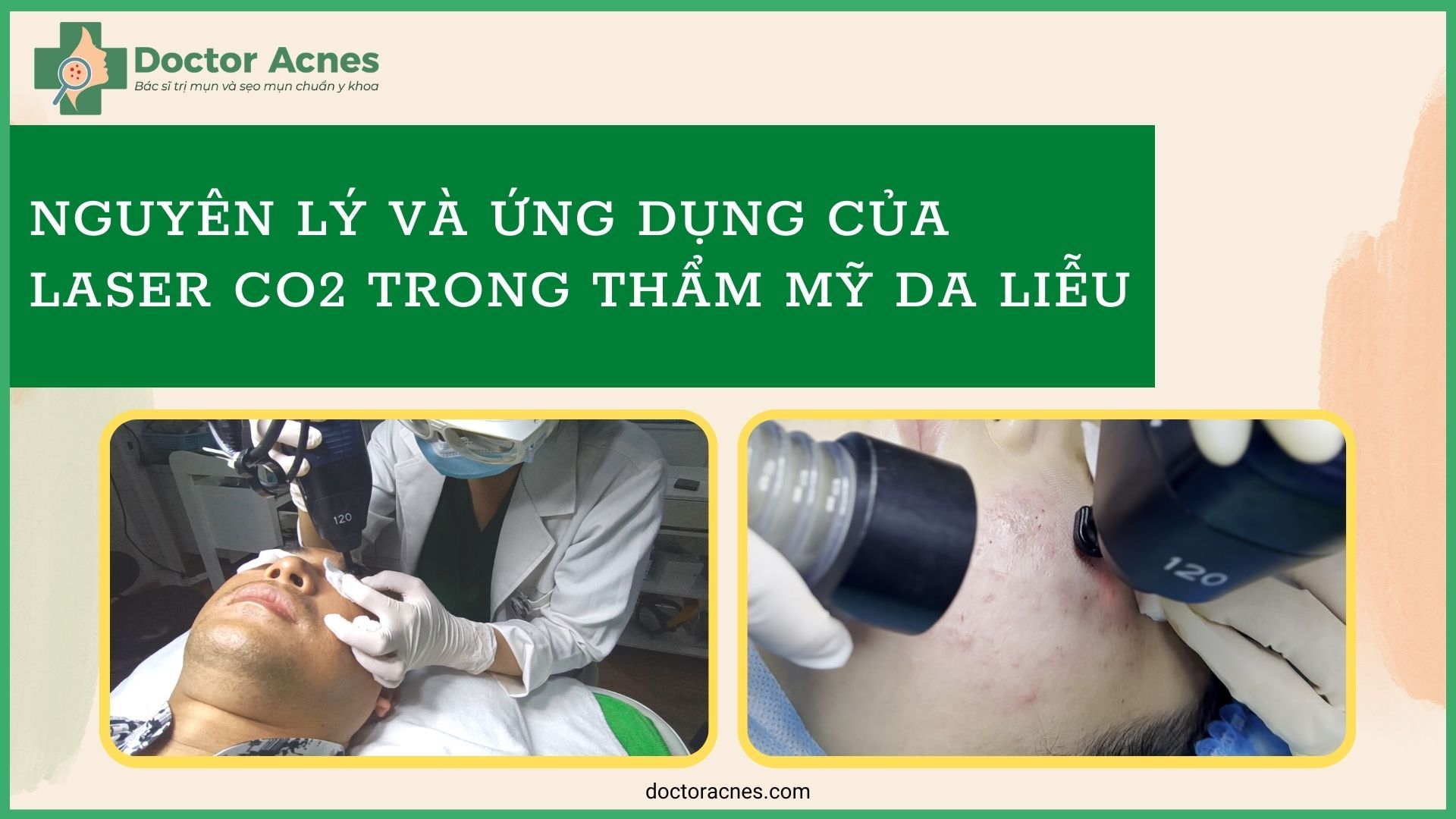 Nguyên lý và ứng dụng của laser CO2 trong thẩm mỹ da liễu - Doctor Acnes