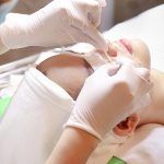 Quy trình lấy nhân mụn chuẩn y khoa tại Phòng khám Doctor Acnes