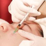 Vai trò của mesotherapy trong thẩm mỹ da liễu