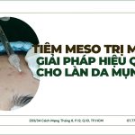 Tiêm meso trị mụn: giải pháp hiệu quả cho làn da mụn