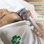 Điện di trị mụn: ưu điểm và quy trình thực hiện
