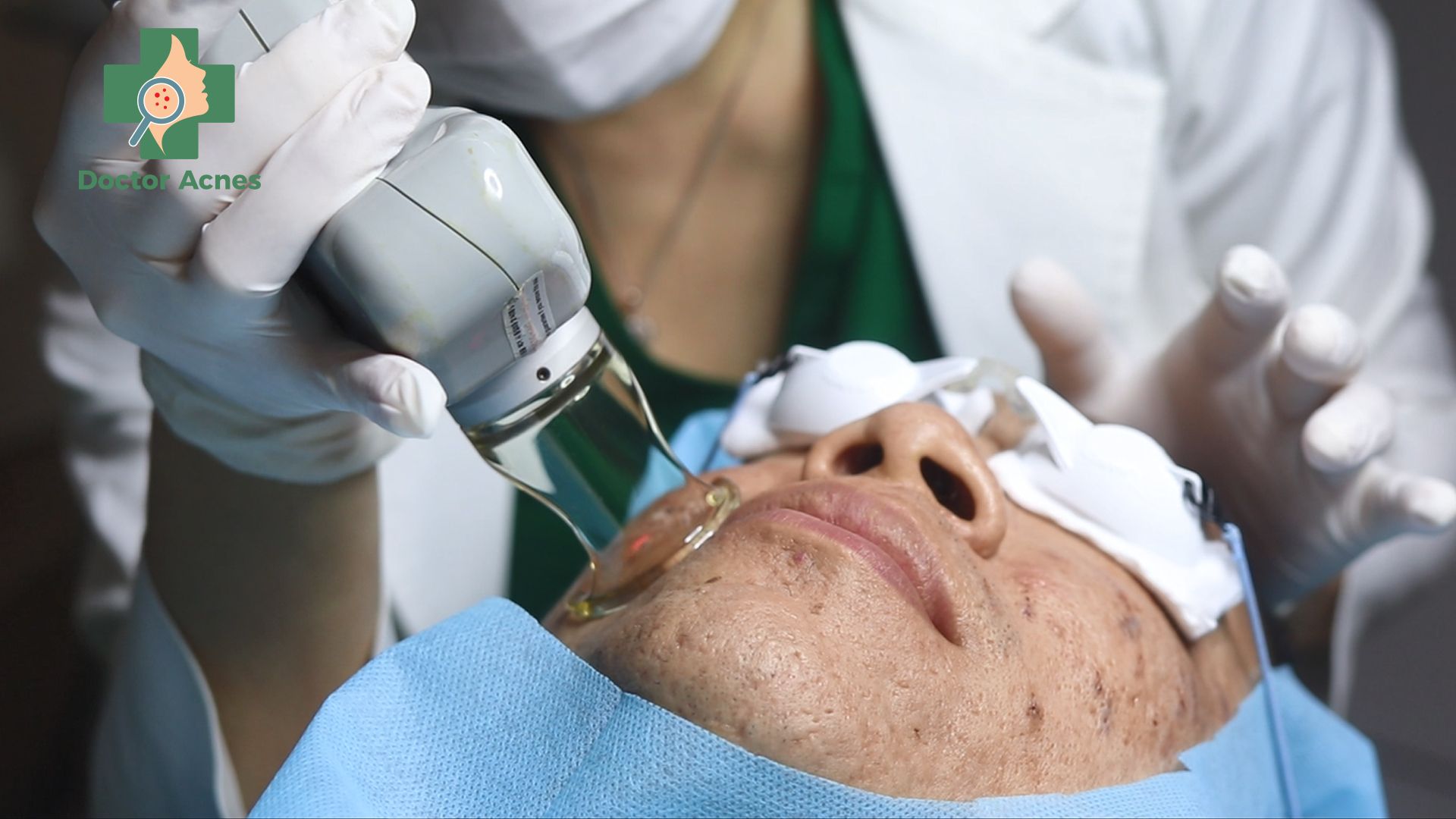 Bác sĩ thực hiện liệu trình trị sẹo Doctor Acnes