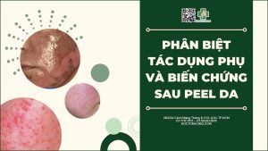 Tác dụng phụ và biến chứng sau peel da