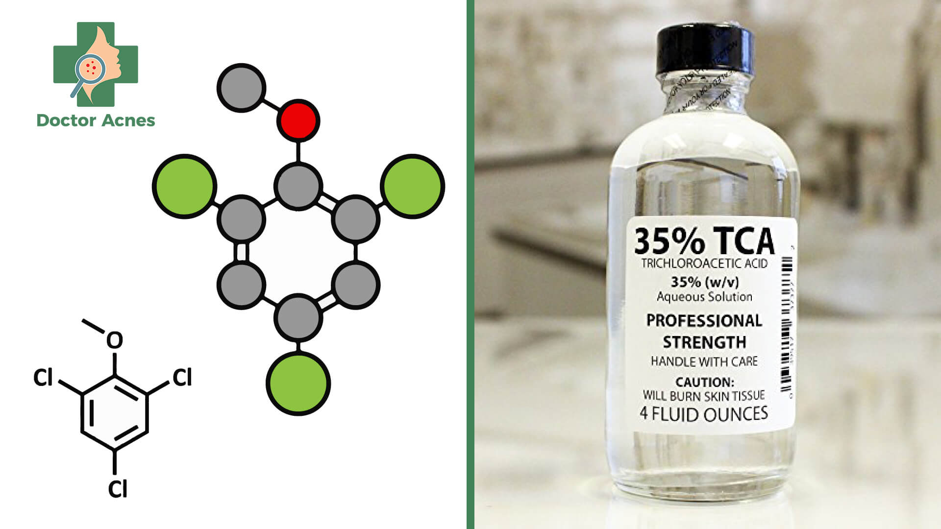 Trichloroacetic acid (TCA) là gì - Doctor Acnes