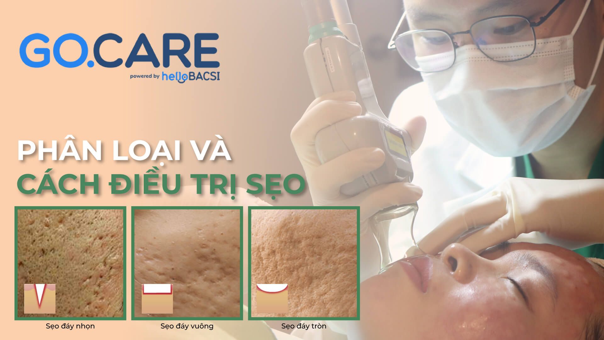 gocare phân loại cách điều trị sẹo