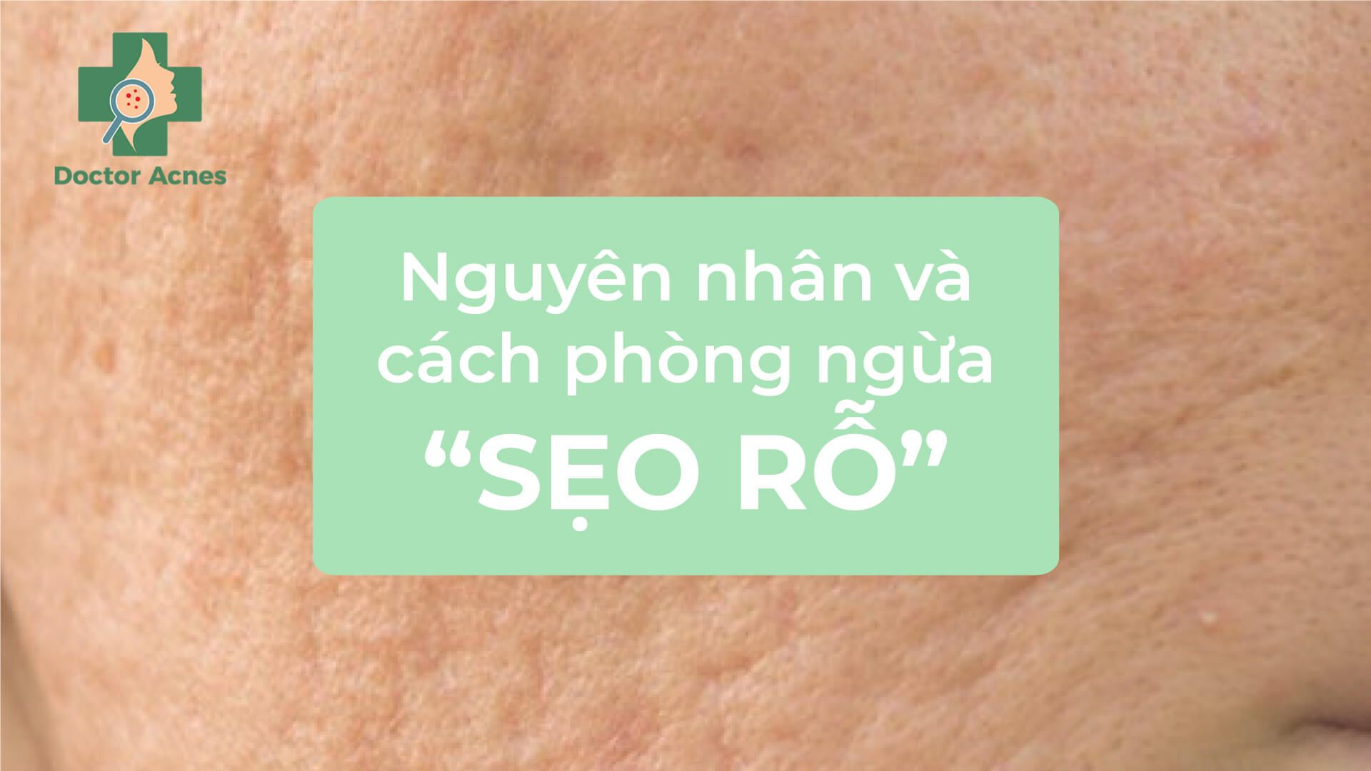 Banner phòng ngừa sẹo rỗ - Doctor Acnes