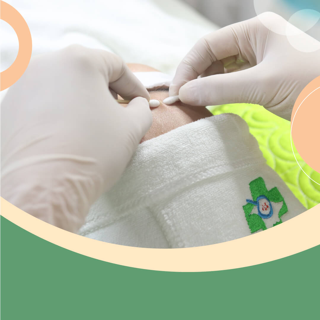dịch vụ trị mụn chuẩn y khoa
