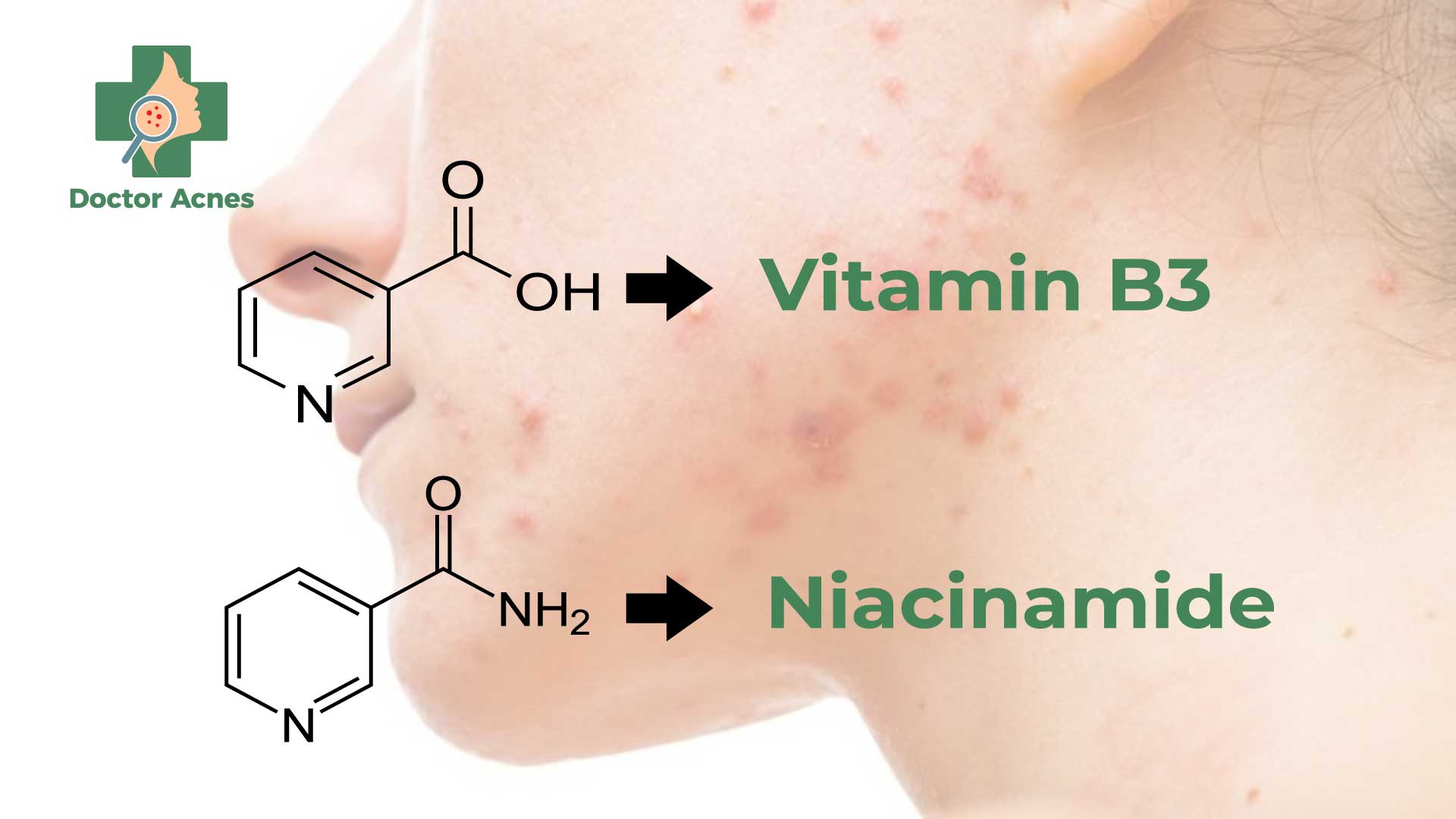Công thức niacinamide - Doctor Acnes