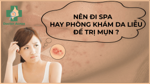 Điều trị mụn ở phòng khám hay spa - Doctor Acnes