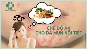 Thumb chế độ ăn mụn nội tiết - Doctor Acnes