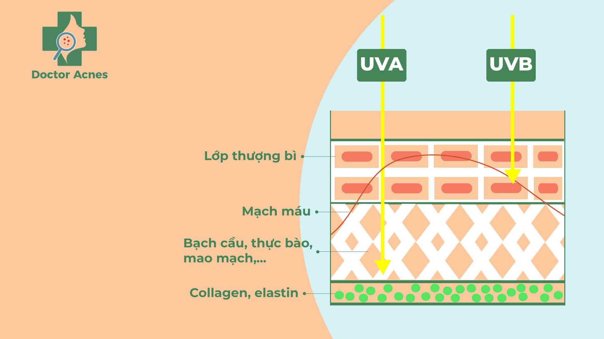Tia UV gây nổi mạch máu trên da - Doctor Acnes