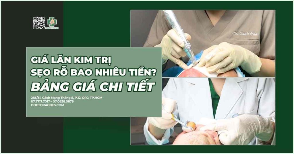 Giá lăn kim trị sẹo rỗ bao nhiêu tiền Bảng giá chi tiết