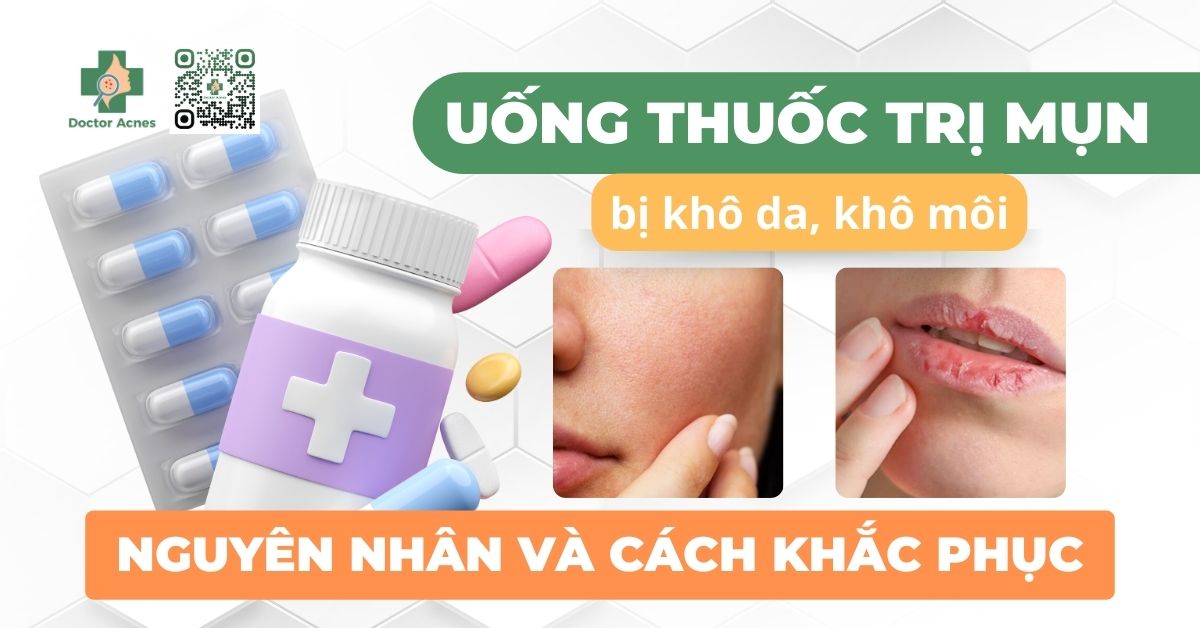 Nguyên Nhân Và Cách Khắc Phục Khô Môi Khi Uống Thuốc Trị Mụn