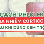 Cách phục hồi da nhiễm corticoid sau khi dùng kem trộn