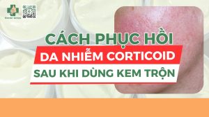 Cách phục hồi da nhiễm corticoid sau khi dùng kem trộn