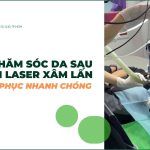 Cách chăm sóc da sau khi bắn laser xâm lấn giúp hồi phục nhanh chóng