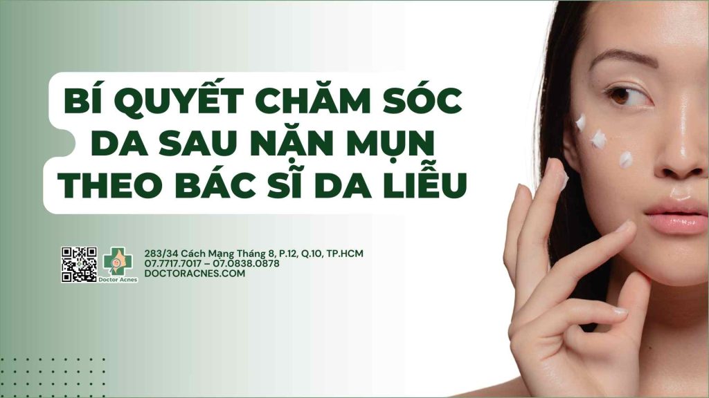 Cách chăm sóc da sau nặn mụn theo Bác sĩ Da liễu