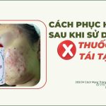 Dùng thuốc Bắc tái tạo da bị đỏ, rát, bong tróc? Hướng dẫn cách khắc phục hiệu quả