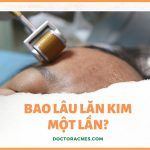 Bao lâu lăn kim một lần, mỗi lần cách nhau bao lâu?