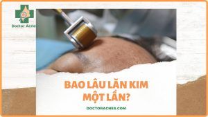 bao lâu lăn kim 1 lần