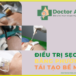Các phương pháp tái tạo bề mặt da trong điều trị sẹo rỗ