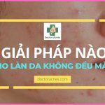 Bí quyết skincare cho da không đều màu từ Bác sĩ Da liễu