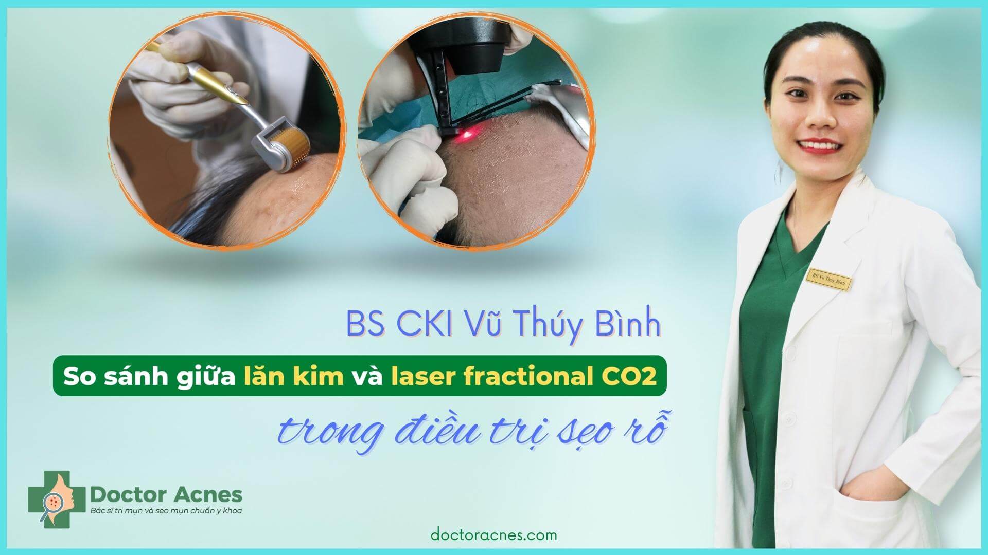 So sánh lăn kim và laser fractional CO2 - lời khuyên của Bác sĩ Da liễu - Doctor Acnes