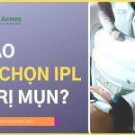 Vì sao nên chọn IPL để điều trị mụn?