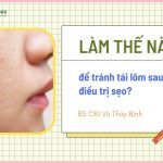 Làm thế nào để tránh tái lõm sau điều trị sẹo rỗ?