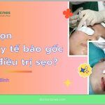 Meso huyết tương giàu tiểu cầu (PRP) và meso growth factor: giải pháp trong điều trị sẹo rỗ
