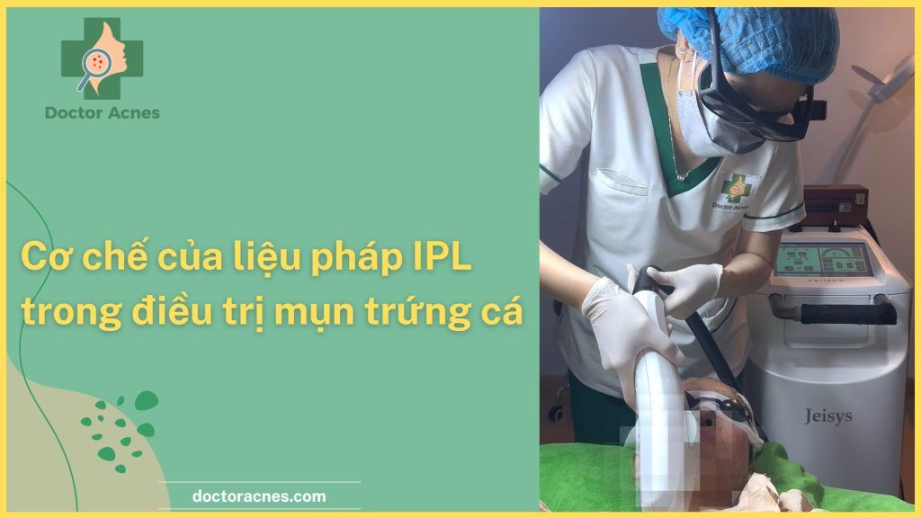 Thumb Cơ chế của liệu pháp IPL trong điều trị mụn trứng cá - Doctor Acnes