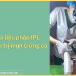 Cơ chế của xung ánh sáng mạnh IPL trong điều trị mụn trứng cá