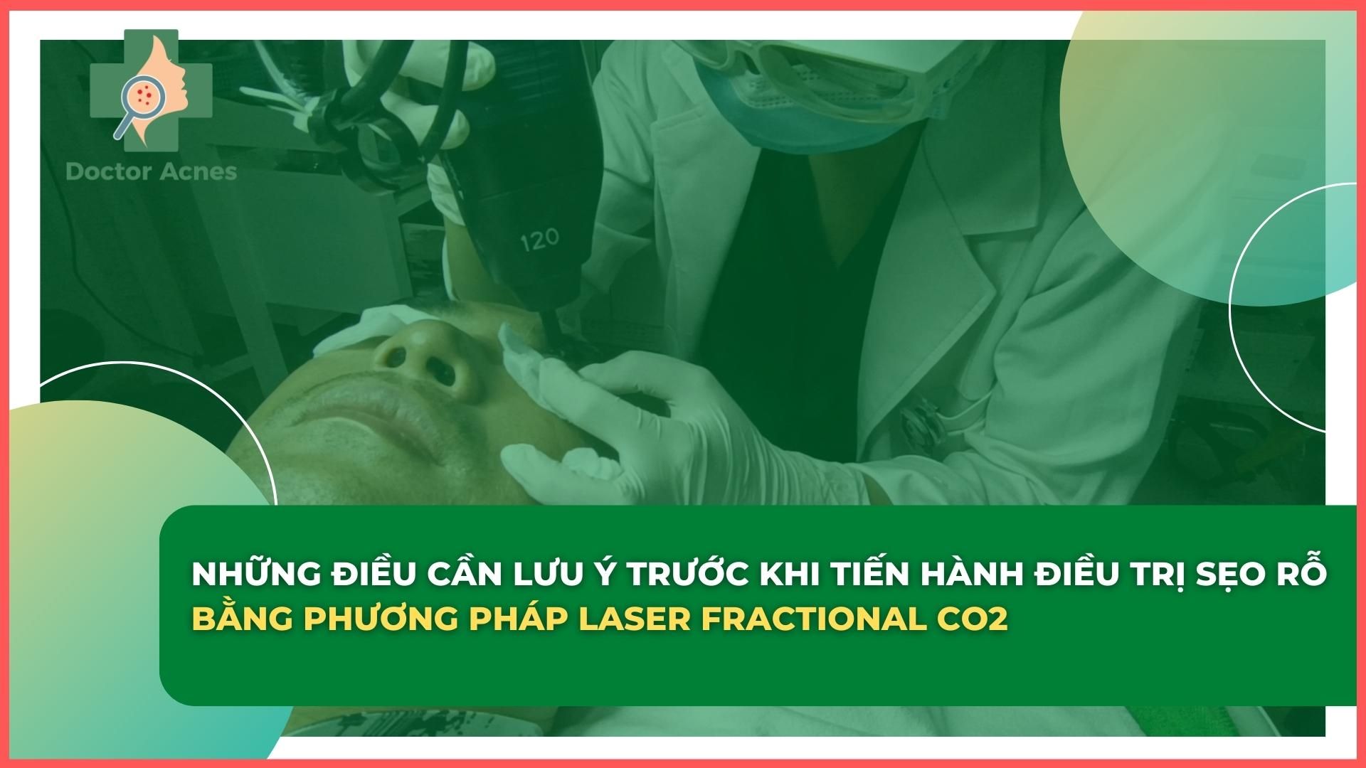 Thumb Những lưu ý khi điều trị sẹo rỗ bằng phương pháp laser CO2 fractional - Doctor Acnes