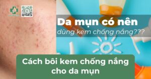 da mụn có nên dùng kem chống nắng