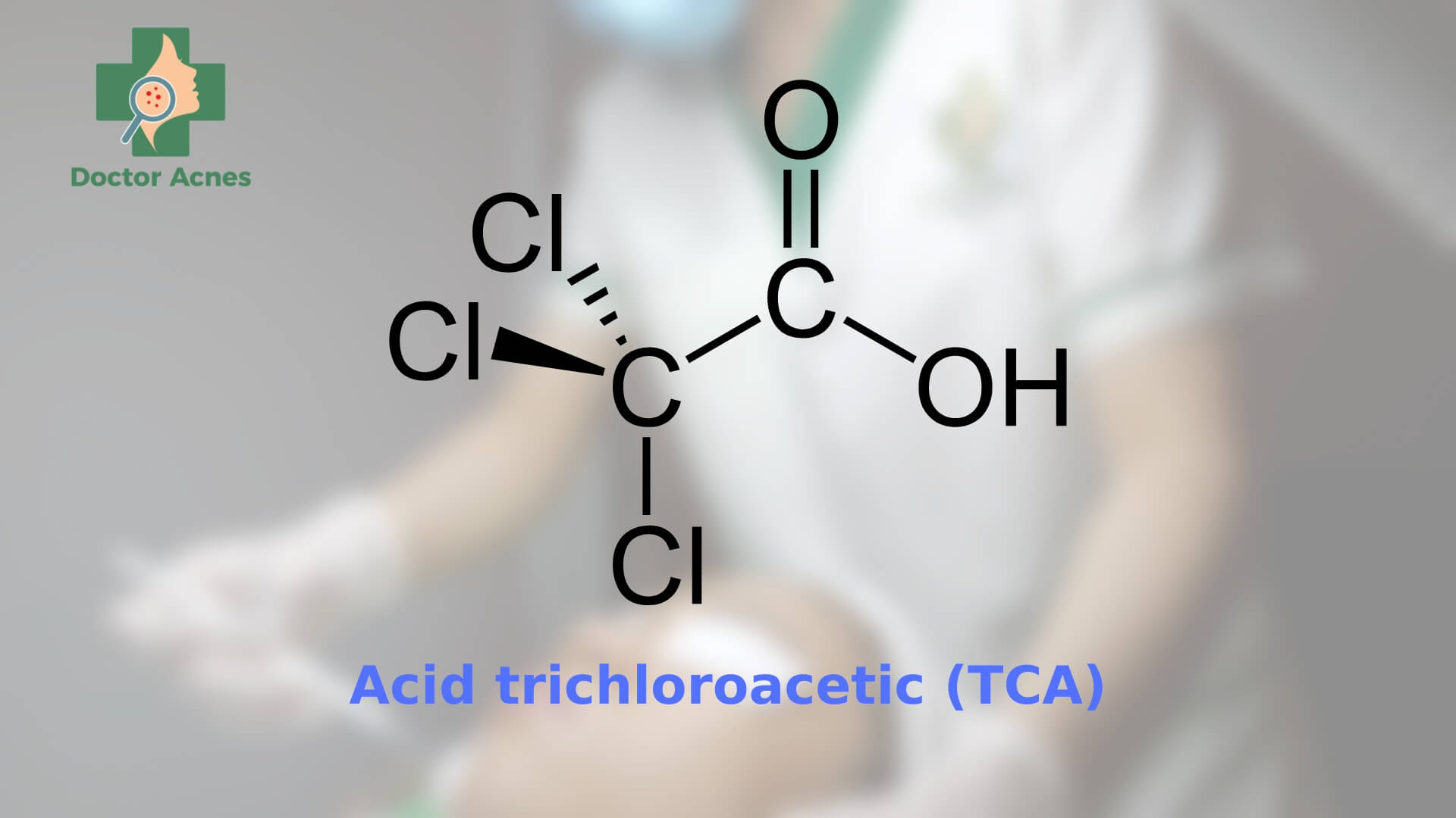 Peel da bằng acid trichloroacetic (TCA) có những lợi ích gì - Doctor Acnes