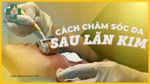 Thumb Cách chăm sóc da sau lăn kim - Doctor Acnes