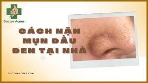 Thumb Cách nặn mụn đầu đen tại nhà an toàn và hiệu quả - Doctor Acnes