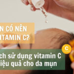 Da mụn có nên dùng vitamin C? Cách sử dụng vitamin C hiệu quả cho da mụn
