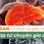 Nóng gan có thật sự gây nổi mụn? Giải đáp từ chuyên gia da liễu