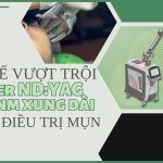 Ưu thế vượt trội của công nghệ laser Nd:YAG 1064 nm xung dài trong điều trị mụn