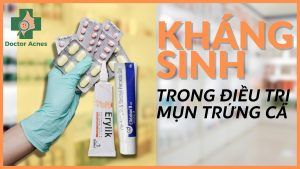 kháng sinh trị mụn