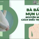 Bà bầu bị mụn lưng: nguyên nhân và cách điều trị hiệu quả