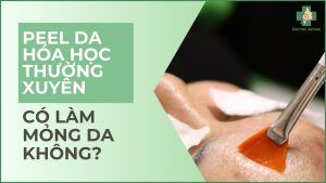 peel da có làm mỏng da không