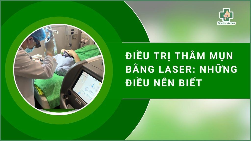 Điều trị thâm mụn bằng laser: những điều nên biết