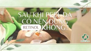 Sau peel da có nên dùng retinol không?