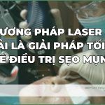 Laser có phải là giải pháp tối ưu để điều trị sẹo mụn?