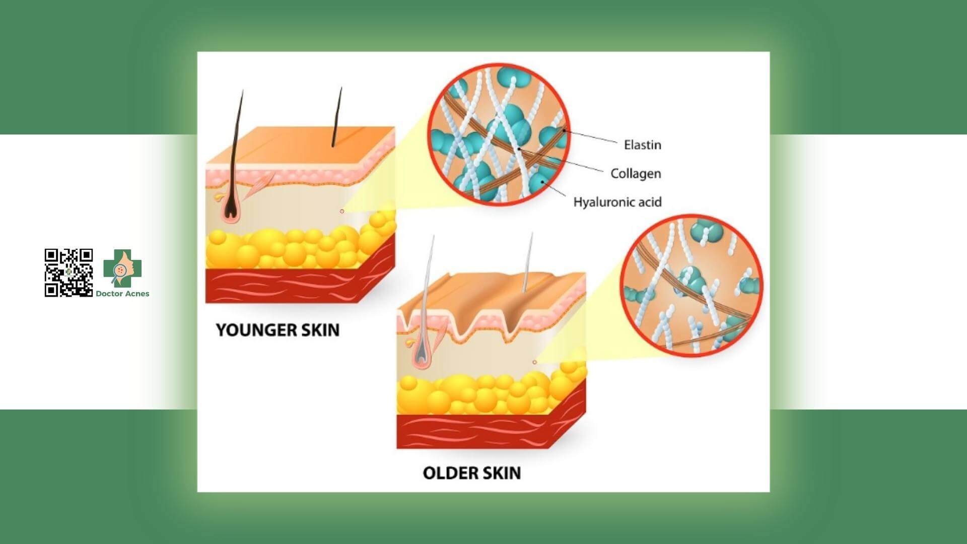 collagen là protein cấu trúc chính trong các mô liên kết