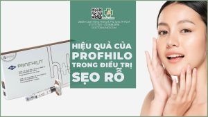 hiệu quả của Profhilo® trong điều trị sẹo rỗ