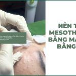 Nên mesotherapy bằng máy hay bằng tay